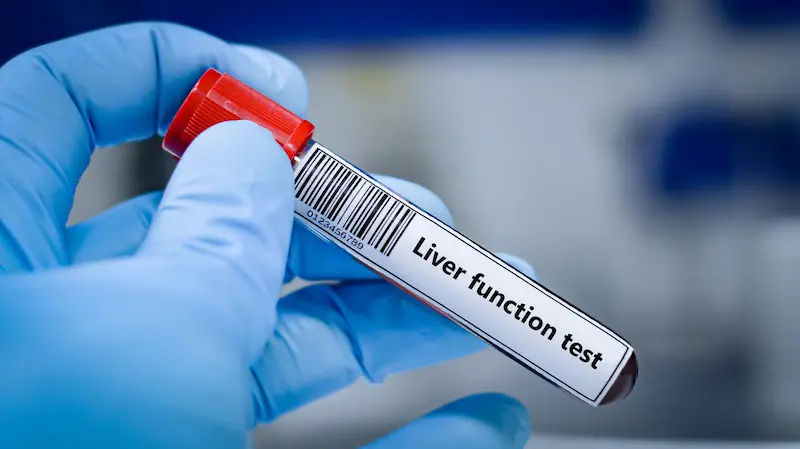 Guide to Liver Function Test